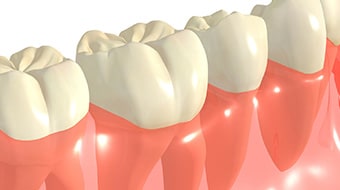 歯周病・予防ケア